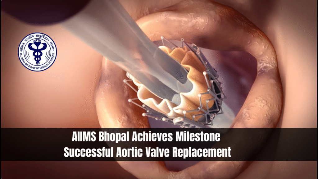 AIIMS Bhopal Achieves Milestone- Successful Aortic Valve Replacement